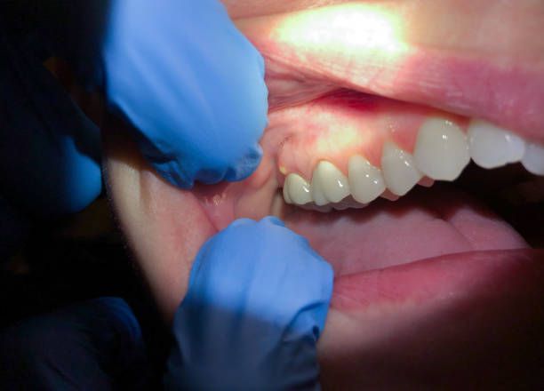 Best Orthodontic Emergency Dentist in Rock Port, MO