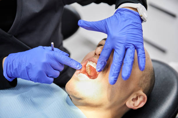 Best Emergency Dentist for Lost Fillings or Crowns in Rock Port, MO
