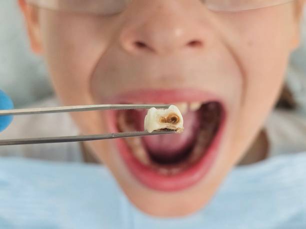 Best Mobile Emergency Dentist in Rock Port, MO